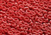 L'ICO participa en el primer assaig clínic al món sobre l'ús de sang de cordó umbilical per erradicar el VIH en càncer hematològic...